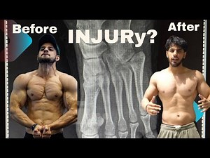 I Lost My Physique After Injury… What Happened Next?”