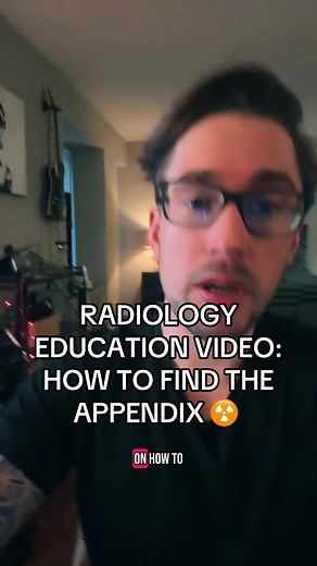 How to Identify the Appendix on a CT Scan