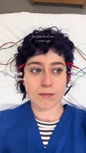 post night shift fun #tmj #tmd #dryneedling #physicaltherapy #recovery | dry needling