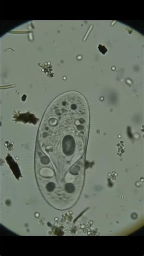 🦠 Paramecium Microscope View | Single-Celled Organism in Motion