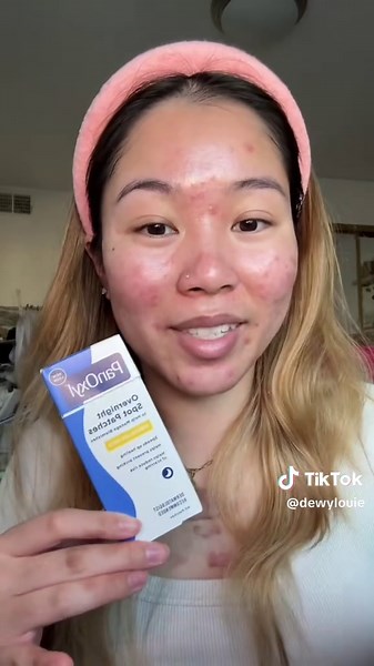 Pimple Patch Review: PanOxyl's Effective Acne Solution