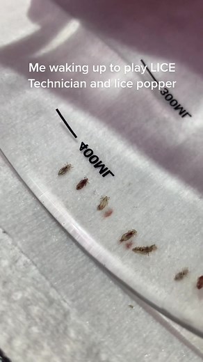 #lovethisgame click here to play lice simulator