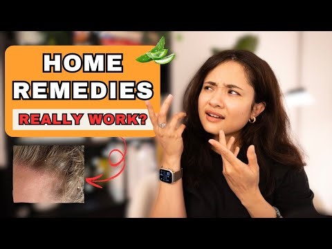 Seborrheic Dermatitis Home Remedies That Actually Work