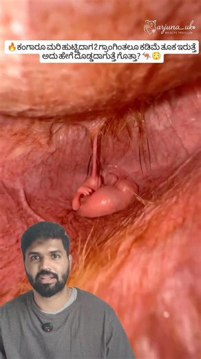 Kangaroo Baby Journey 🦘 | From Jellybean Size to Pouch Life #shorts #wildlife