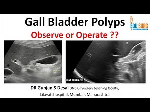 Gallbladder Polyps: When to Operate? Updated Management Algorithm | Evidence-Based Surgical Guide