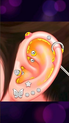 ASMR Ear Cleaning Animation 👂✨ | Deep Ear Wax Removal | No Talking#animation