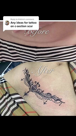Creative C-Section Scar Tattoo Ideas for Covering Up Scars