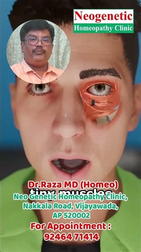 Eye Twitching? Here’s the Real Reason! 👁️😳 | Neogenetic Homeopathy