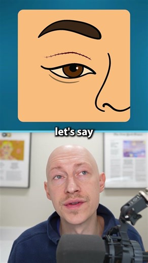 Plastic Surgery Is NOT Always Reversible