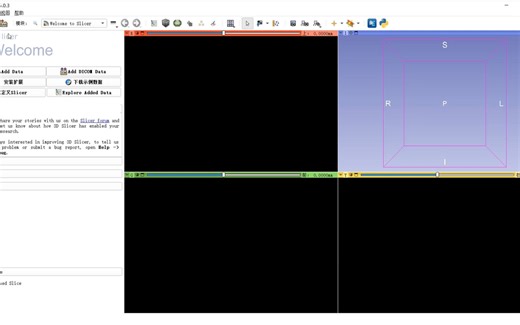 Slicer 5.0.3中文版 可视化医学图像处理 下载安装指南 零基础快速学会