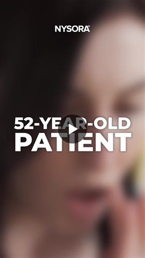 Ultrasound Simplified! Part 7- Mental Nerve block for facial pain management Stepwise approach to mental nerve block using Ultrasound Guidance for management of mandibular pain secondary to… | Sadiq B.