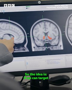 564K views · 3.4K reactions | Matt delves into the science behind addiction and the potential for future groundbreaking treatments. Watch Matt Willis: Fighting Addiction on iPlayer #MattWillis #FightingAddiction #BBCMentalHealthSeason #iPlayer | BBC One | Facebook