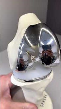 Total Knee Replacement - Sphere by Medacta 360 degree