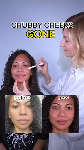 Chubby cheeks gone Do these 3 exercises for 30 seconds daily and lea... Get My Secret ➡️ https://stan.store/pitfire | Pitfire Face Fitness