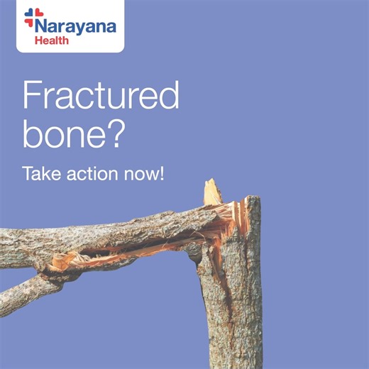 2.3K views | A fractured bone can be a painful setback, but quick action will help you in faster recovery. Immediate care and timely treatment can help you prevent further damage and get you back on your feet sooner. #BoneCare #WellBeing #TakeCare #NarayanaHealth | Narayana Health | Facebook