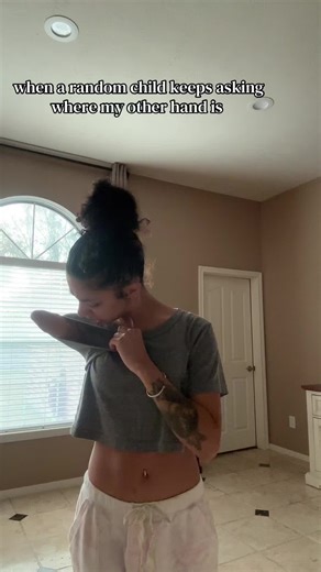 Exploring Amputee Humor and Daily Life Adaptations