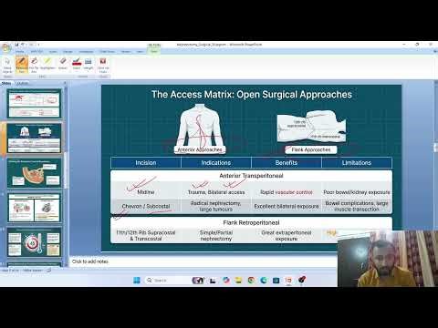 Nephrectomy Surgery | Step-by-Step Procedure | OT Technology & Surgical Students