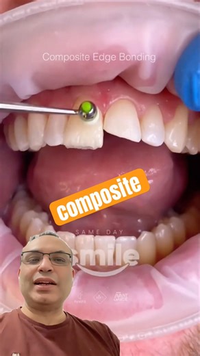 Broken Tooth? Watch This Fix! 😬➡️😁 #dentist #youtubeshorts #dentistry