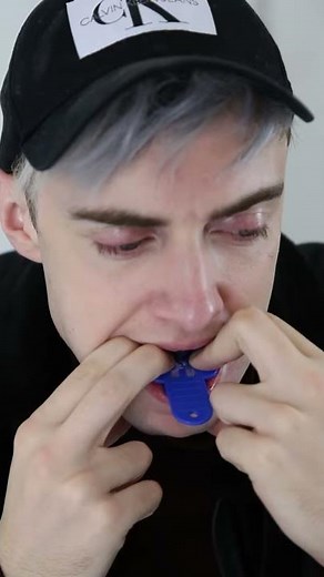 MUST WATCH - EASY instasmile impression demonstration