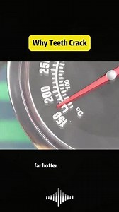 Why Teeth Crack #Science #knowledge #fyp #usa🇺🇸 #tiktok | Think Lab
