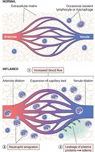 Vascular Permeability : Causes, Pathogenesis, Patterns of increased Vascular Permeability, Disorders And MCQs for NEET, GPAT, CSIR NET JRF - Gpatindia: Pharmacy Jobs, Admissions, Scholarships, Conference,Grants, Exam Alerts