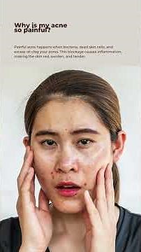 Why is my acne itchy, painful, and so red