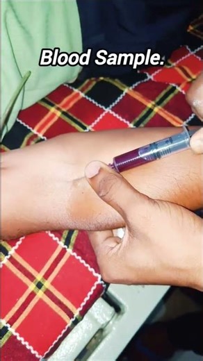 Blood sample kaise lete hain | how to collect blood sample #shorts #bloodsample #blood #ytshorts
