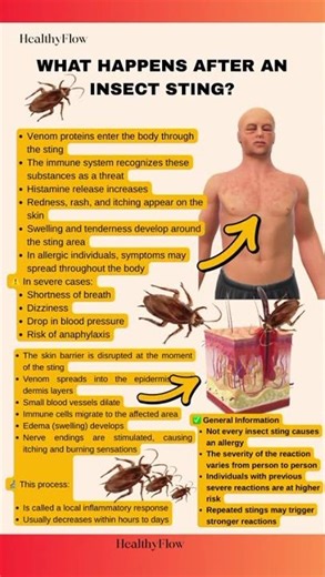 What Happens to Your Body After an Insect Sting?
