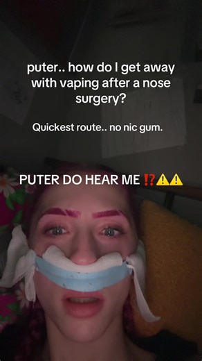 radioactivekittypoop (@radioactivekittypoop)’s video of nose