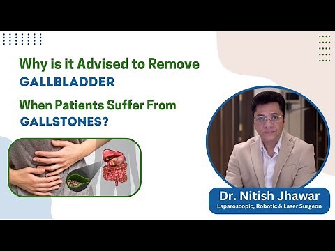 Why Should Gallbladder Be Removed (And Not Only Gallstone Removal)? || Dr. Nitish Jhawar