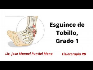 Esguince de Tobillo, Grado 1, Que hacer para curarlo? - FisioterapiaRD