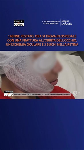 Pestato con pugni, calci e schiaffi assieme ad un suo amico da una baby gang di 12 persone, questo ragazzo di soli 14 anni oggi è in ospedale con una frattura all'orbita dell'occhio, un'ischemia oculare e tre buchi nella retina a causa del tirapugni con cui è stato colpito. Il servizio completo di Letizia Modica a #Fuoridalcoro è su Mediaset Infinity