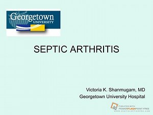 SEPTIC ARTHRITIS - SlideServe