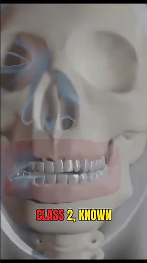 Malocclusion: Defined, Types Explained & Key Causes! #dentalartistry #shorts