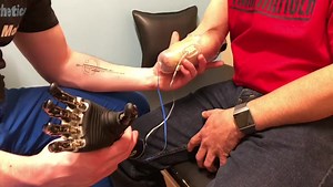 The beginning phases of fitting and designing a transradial myoelectric prosthesis 🦾 #prostheticsinmotion #pim #teampim #amputee #ottobock #amputeesofinstagram #newyork #iamadaptive #adaptandovercome #adaptive #upperextremity #prostheticarm #function #limbdifference #myoelectric | Prosthetics In Motion