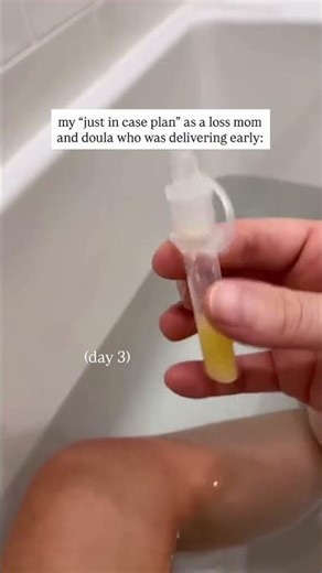 i had a scheduled cesarean at 37+3 with my daughter as a loss mom, it was hard for me to envision