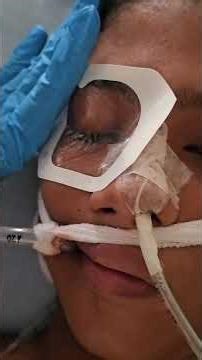 PICU PEARL: OPTIC NERVE SHEETH DIAMETER