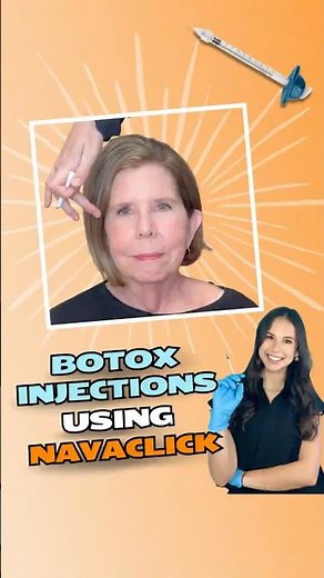 Botox Injections Using NavaClick | Precision, Comfort & Consistency in Every Treatment