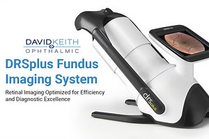 Retinal Imaging Technology | David Keith Ophthalmic