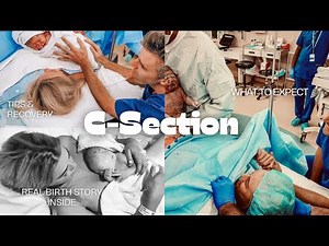 Caesarean Section (C-Section), What to Expect, Tips, Recovery, Birth Story