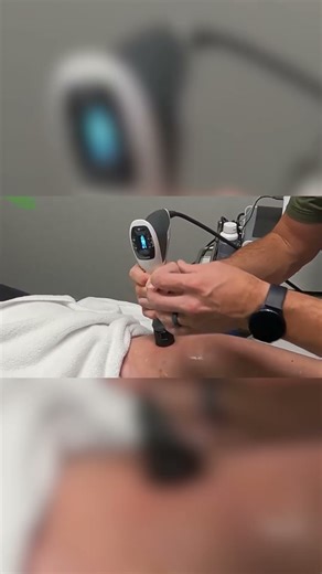 SW13B Radial Shockwave Machine In Action!