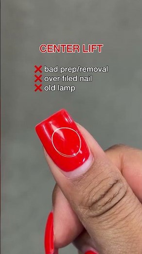 Why Your Nails Are Lifting in Different Areas