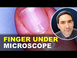 How to see BLOOD without hurting yourself