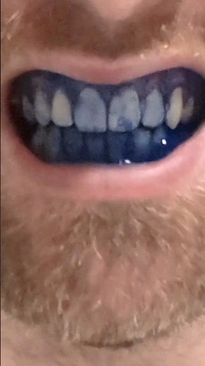 How to use disclosing tablets #shorts #teeth