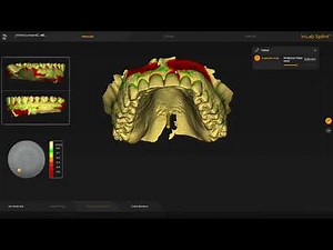 * IDDA MiniBytes - How to design a SPLINT with Inlab 22 with STL's from ANY scanner *