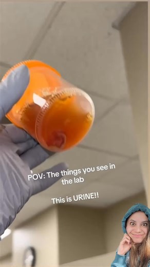 21K views · 208 reactions | YES, parasites can INFEST the bladder ...