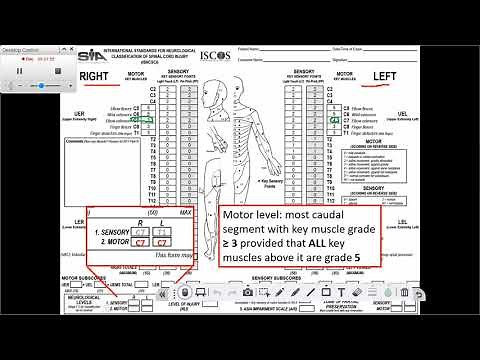 Determining the Motor Level
