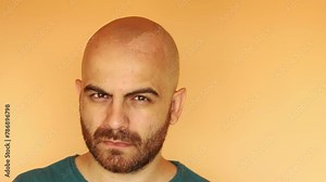 Bearded bald man with heavily sunburned head showing where the skin's peeled off. Warm summer colors and tan skin. Danger of skin cancer
