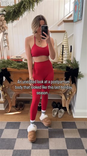 Dr. Michelle Gaubert, PT, DPT | Holistic Pain Solutions | This is a real, unedited look at a postpartum body from someone who looked very different just one year ago. I won’t lie… the body changes... | Instagram