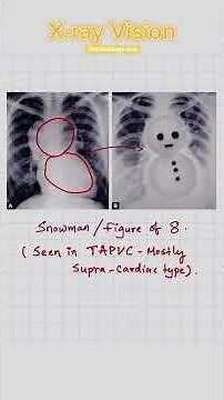 How X-Rays Actually Work (Explained)
